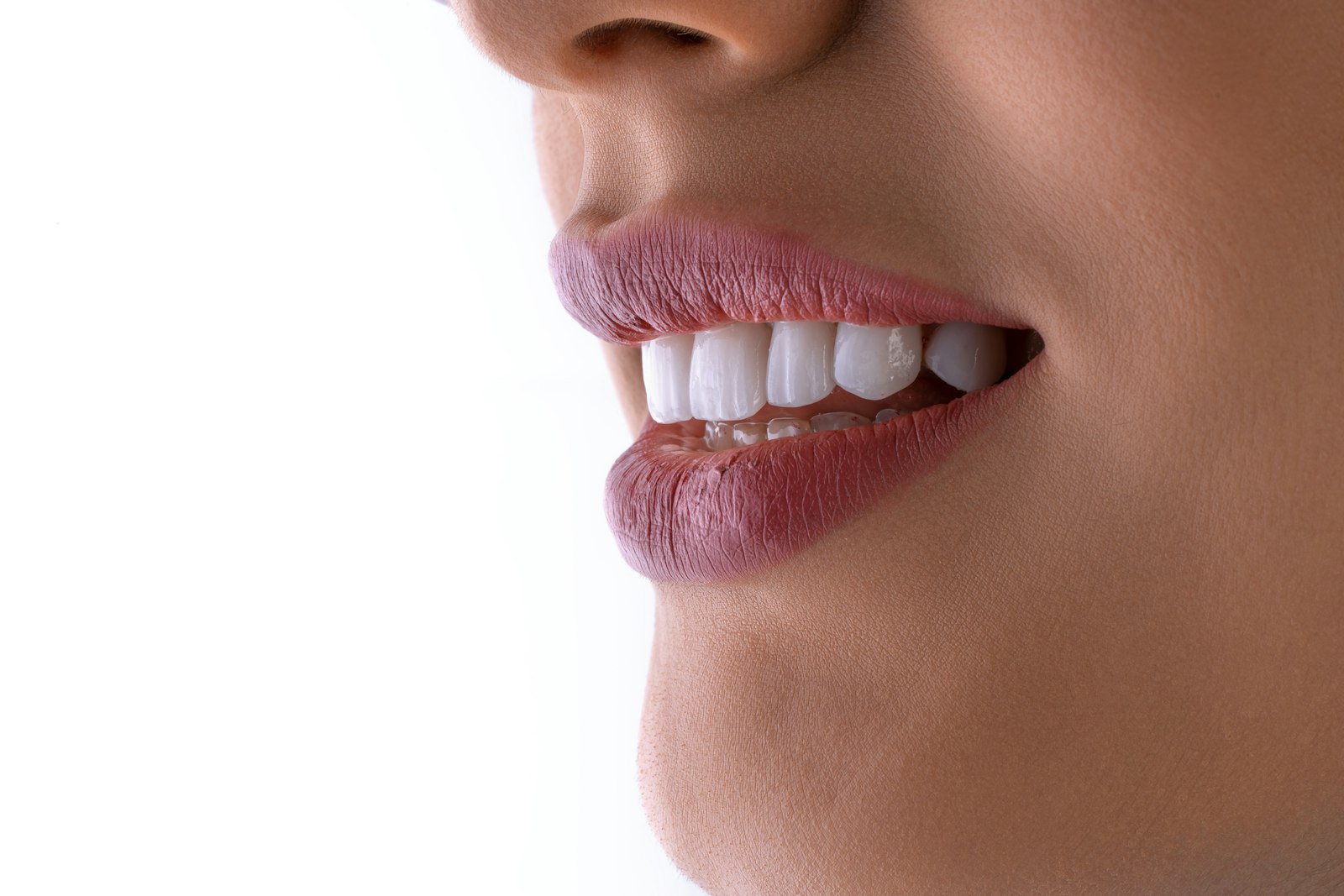 Procedimento de odontologia estética — foto ilustrativa temporária
